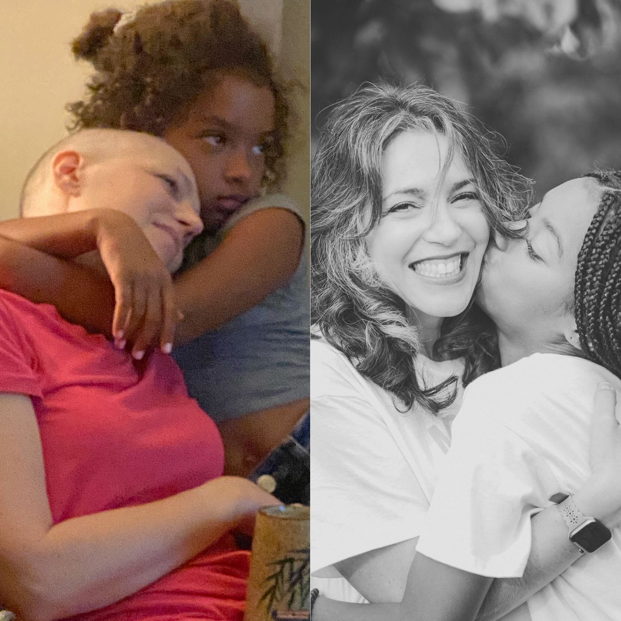 Kim con su hija antes y después del tratamiento