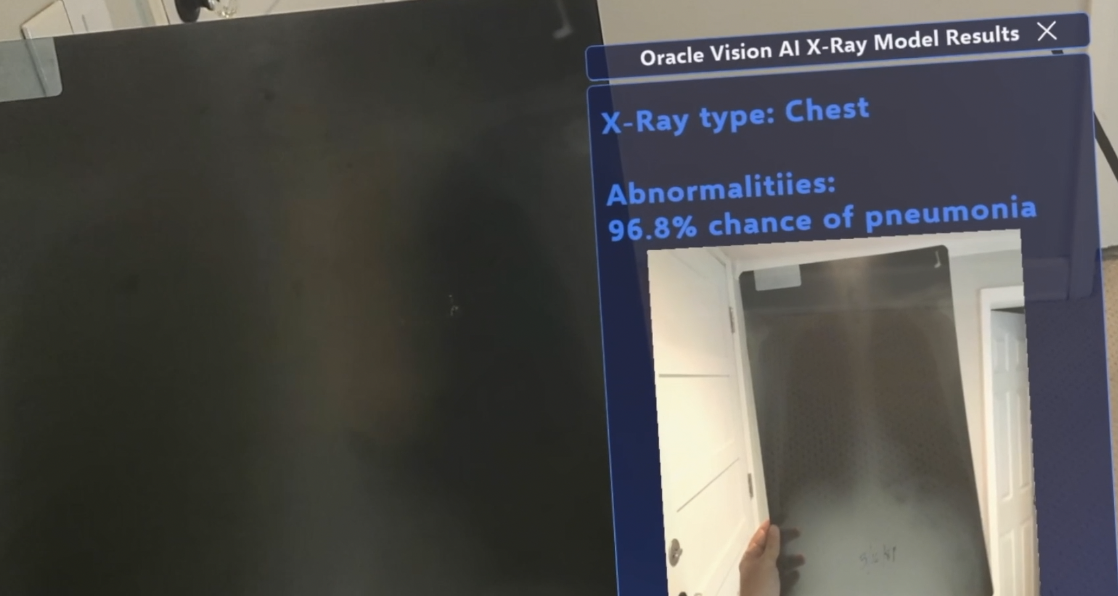 XR x-ray vision ai