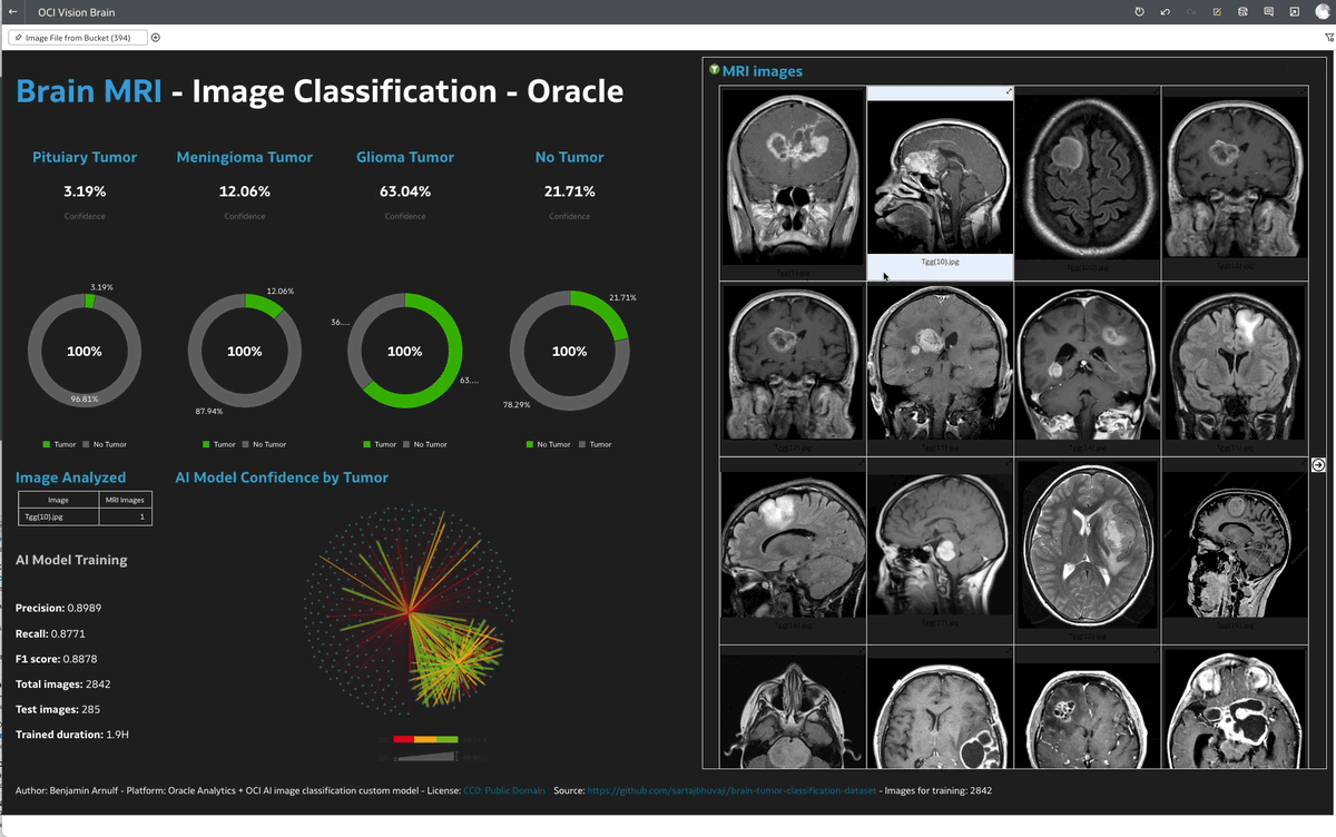 Data Visualization que muestra el uso de un modelo entrenado de OCI AI Image Classification con 3000 imágenes de resonancia magnética públicas - Autor: Benjamin Arnulf